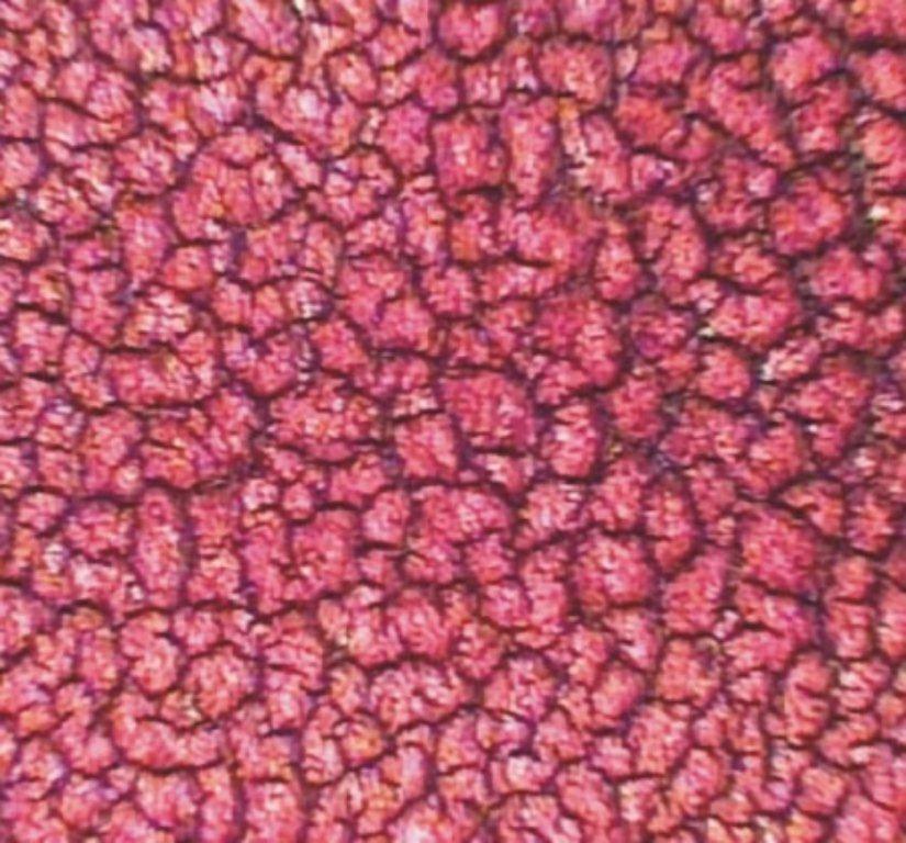 Dry blood sample example of healthy blood, what are my issues; is it Liver & Kidney Stress, Circulation & Cholesterol, Uric Acid, Immune Weakness, Acidity, Parasites, Yeast/Candida, Degeneration, Hormones, Inflammation