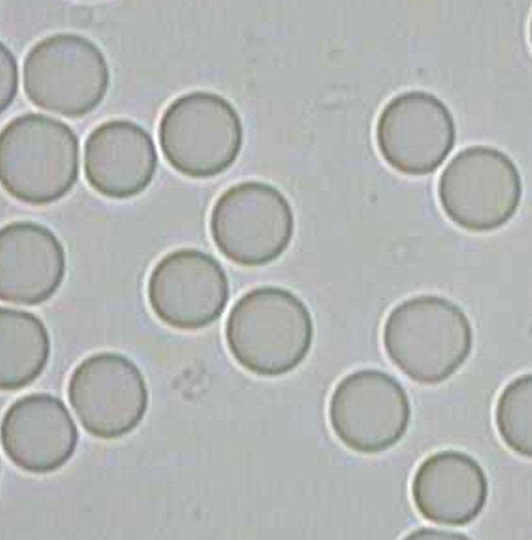 A sample of live blood demonstrating healthy sells, uncovers many Hidden issues; Fatigue, Weight & Digestion, Sleeplessness, Headaches & Allergies, Free Radical Damage, Toxicity, Vitamin/Mineral Deficiency